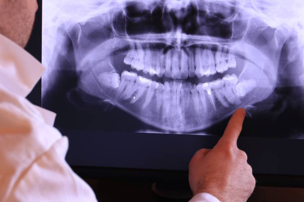 Best Urgent Dental Care  in Fredericktown, MO