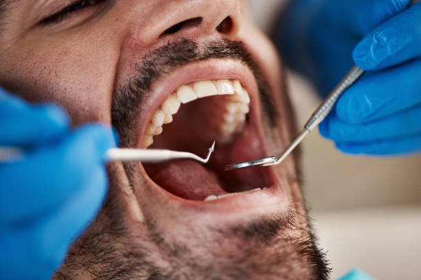 Best Cracked Tooth Emergency Dentist  in Fredericktown, MO